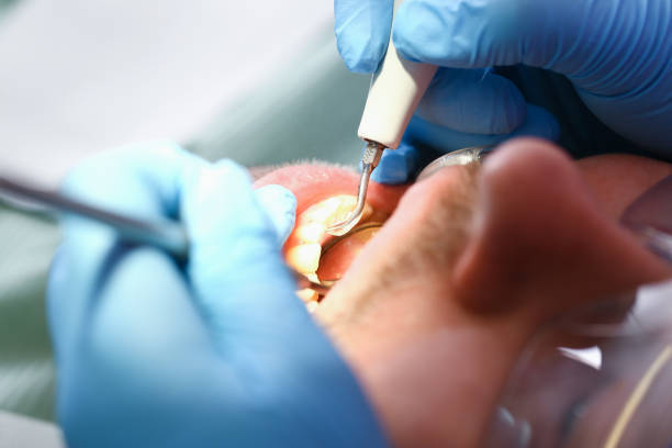 Best Dental Abscess Treatment in Warroad, MN