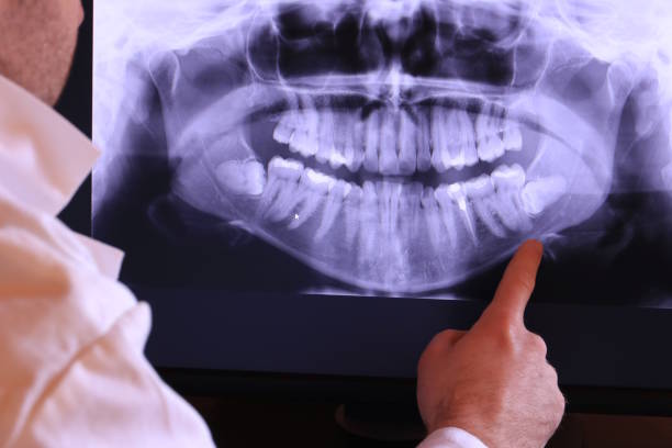 Best Broken or Chipped Tooth Repair in Warroad, MN